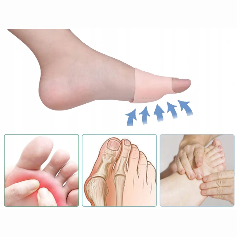 Correttore alluce con cuscinetto in gel morbido Cuscinetto di protezione e correzione per Hallux Valgus